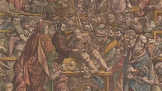 Vesalius